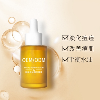 大堂区_祛痘精华原液OEM